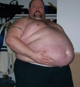 amazingshockingcrazysurprisinghugebigpotbeerbellysaggystomachsflabbytummies